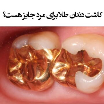 چرا طلا برای مرد حرام است؟ - تصویر 2